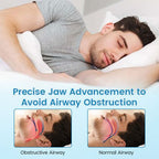 Aurenza Shop anti-snoring and teeth grinding protector, clear mouthguard for sleep, shown in close-up on a white background.