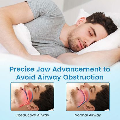 Aurenza Shop anti-snoring and teeth grinding protector, clear mouthguard for sleep, shown in close-up on a white background.
