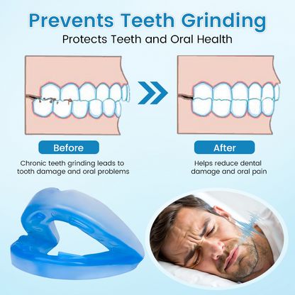 Aurenza Shop anti-snoring and anti-grinding teeth protector, showing a clear mouthguard designed for sleep comfort and dental protection.