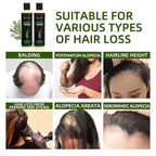 Aurenza Shop Rosemary Shampoo by Tgideas in a clear bottle with label, ready for hair washing and scalp care.