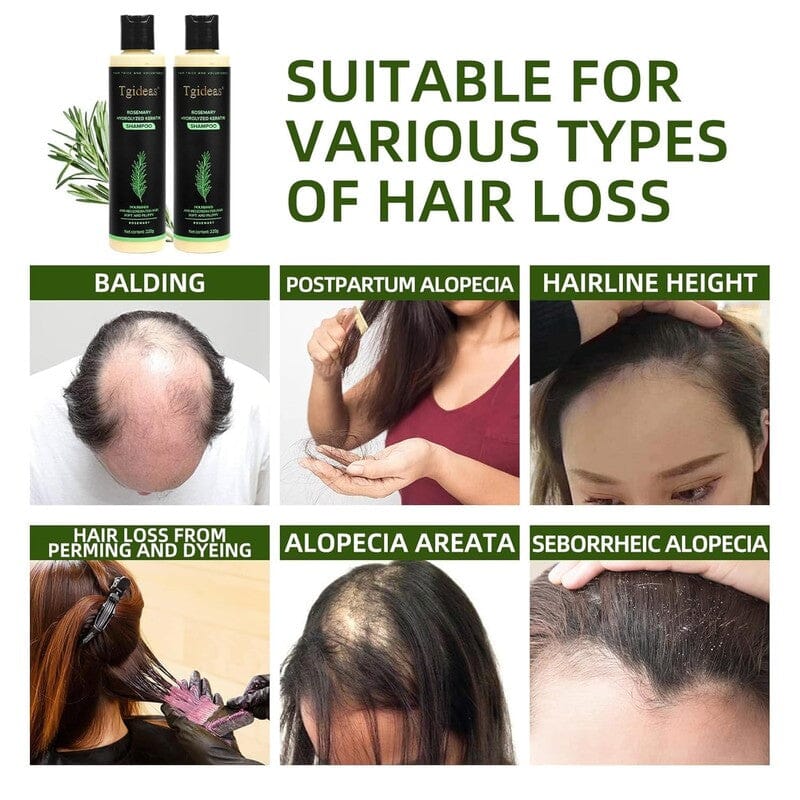 Aurenza Shop Rosemary Shampoo by Tgideas in a clear bottle with label, ready for hair washing and scalp care.