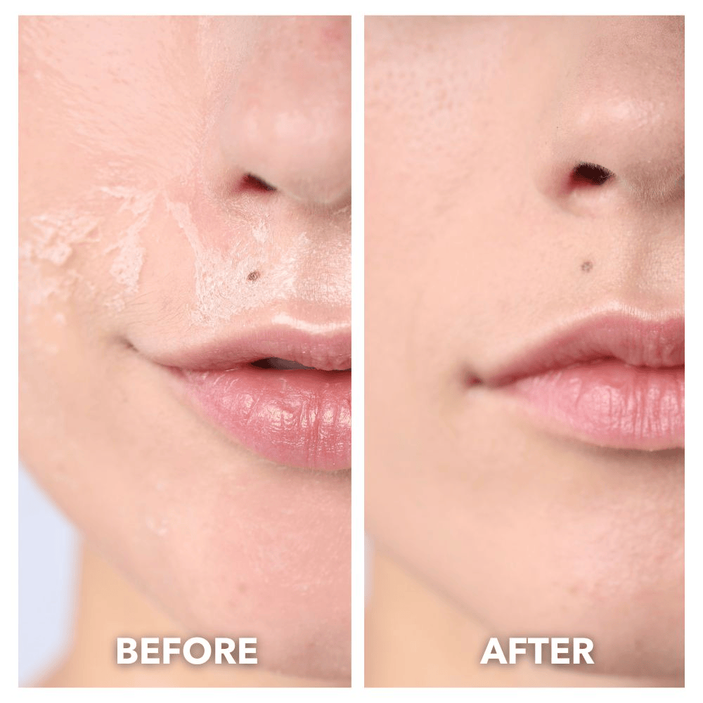 Aurenza Shop LUXE™ Pro Max LED Therapy Neck Add-On device for enhancing LED facial treatment, shown in a close-up image.