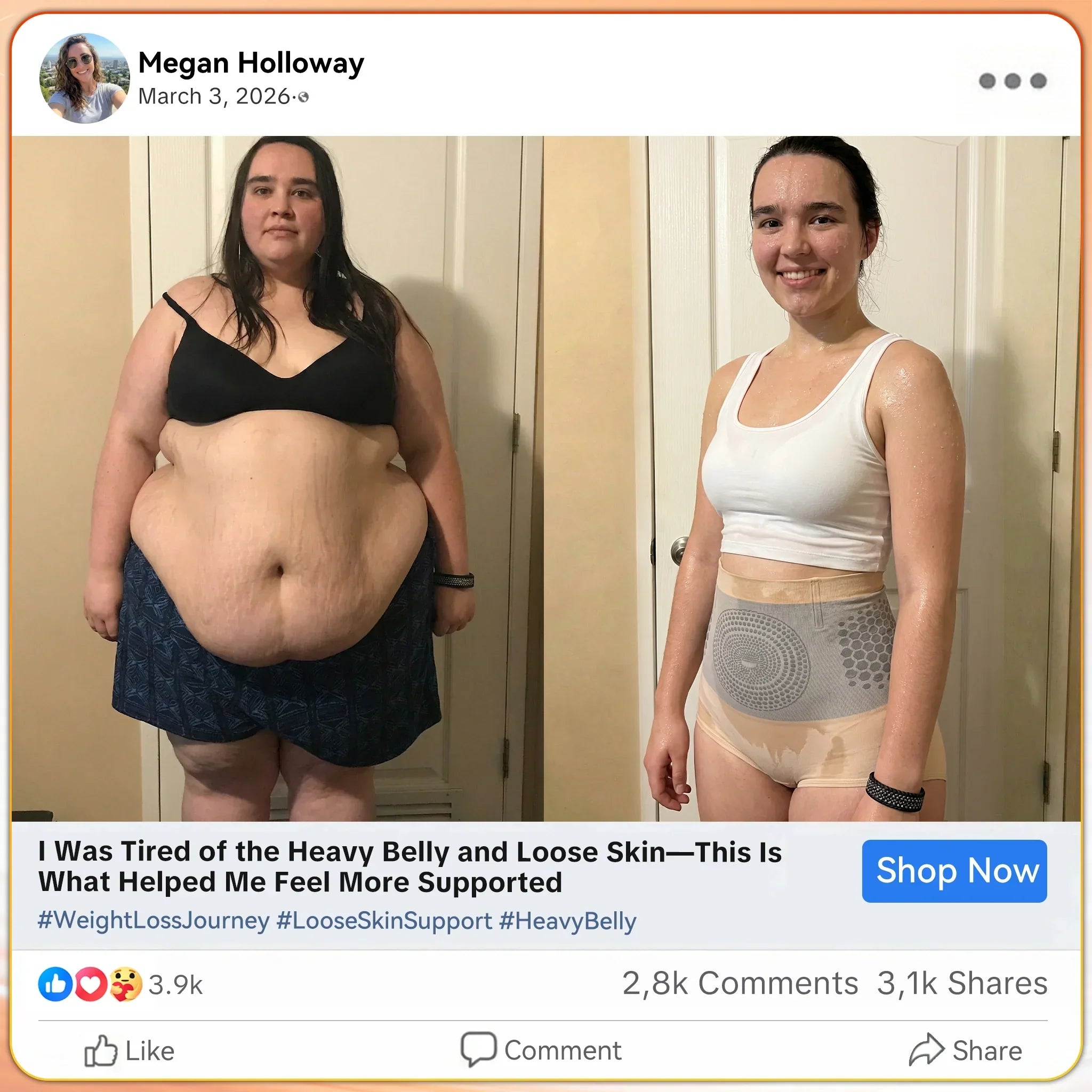 Aurenza Shop black M-sized micro-particle sculpting and fat-burning shorts with Moringa and Berberine for slimming and toning.