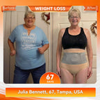 Black Aurenza Shop Moringa & Berberine 4-in-1 micro-particle sculpting and fat-burning shorts, designed for effective body shaping.