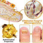 Aurenza Shop Unpree Kolirin Bee Venom Nail Fungus Treatment Cream jar with product label, shown on a neutral background.