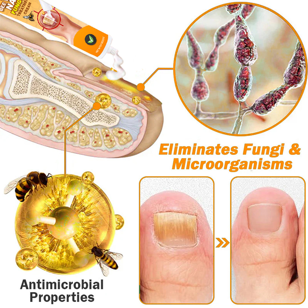 Aurenza Shop Unpree Kolirin Bee Venom Nail Fungus Treatment Cream jar with product label, shown on a neutral background.