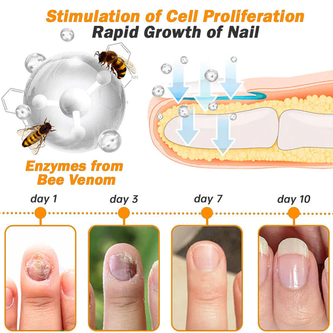 Aurenza Shop Kolirin Bee Venom Nail Fungus Treatment Cream jar with label and product details.