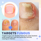 Aurenza Shop SUPTRUCK™ Nail Fungus LED Light Therapy Device for treating nail fungus, shown in a sleek compact design.