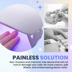 Aurenza Shop SUPTRUCK™ Nail Fungus LED Light Therapy Device for treating nail fungus with a compact, handheld design.