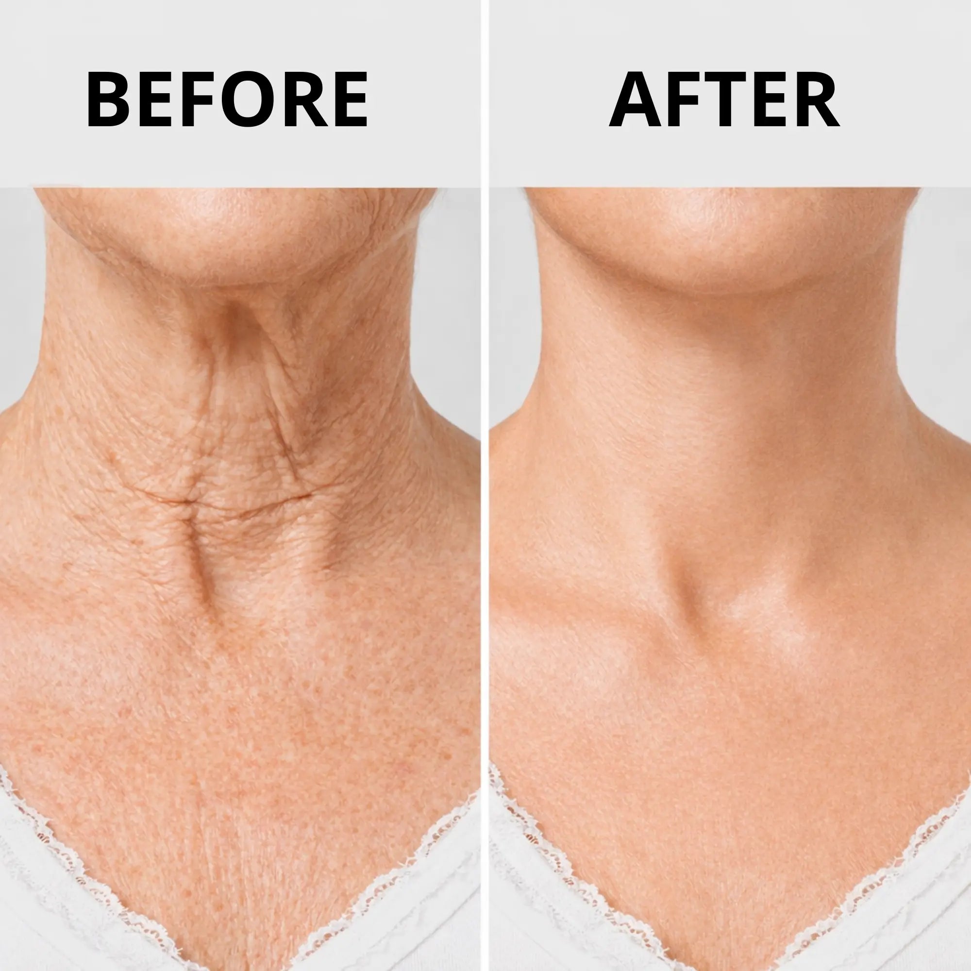 Aurenza Shop Bee Venom Firming Stick with natural beeswax and bee venom for skin tightening and anti-aging benefits.