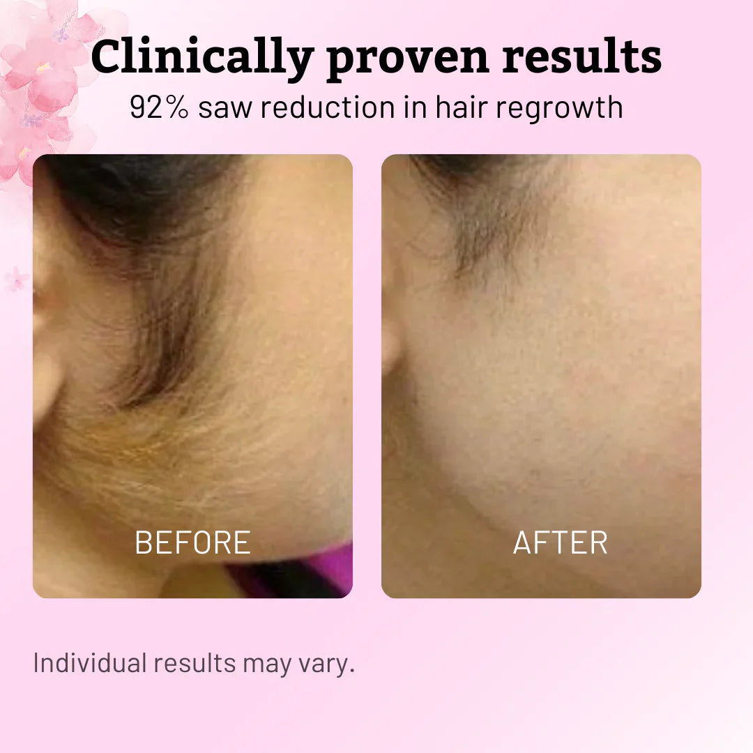 Aurenza Shop Caramela Beauty Cyperus Rotundus Oil for natural hair reduction, 60ml bottle, with plant extract label.