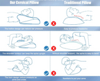 Aurenza Shop Cervical Pillow showing ergonomic design with plush cover for neck support and comfort during sleep.