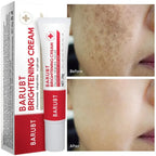 Aurenza Shop dark spot and freckle corrector face cream with niacinamide and vitamin C, showing the jar and product packaging.