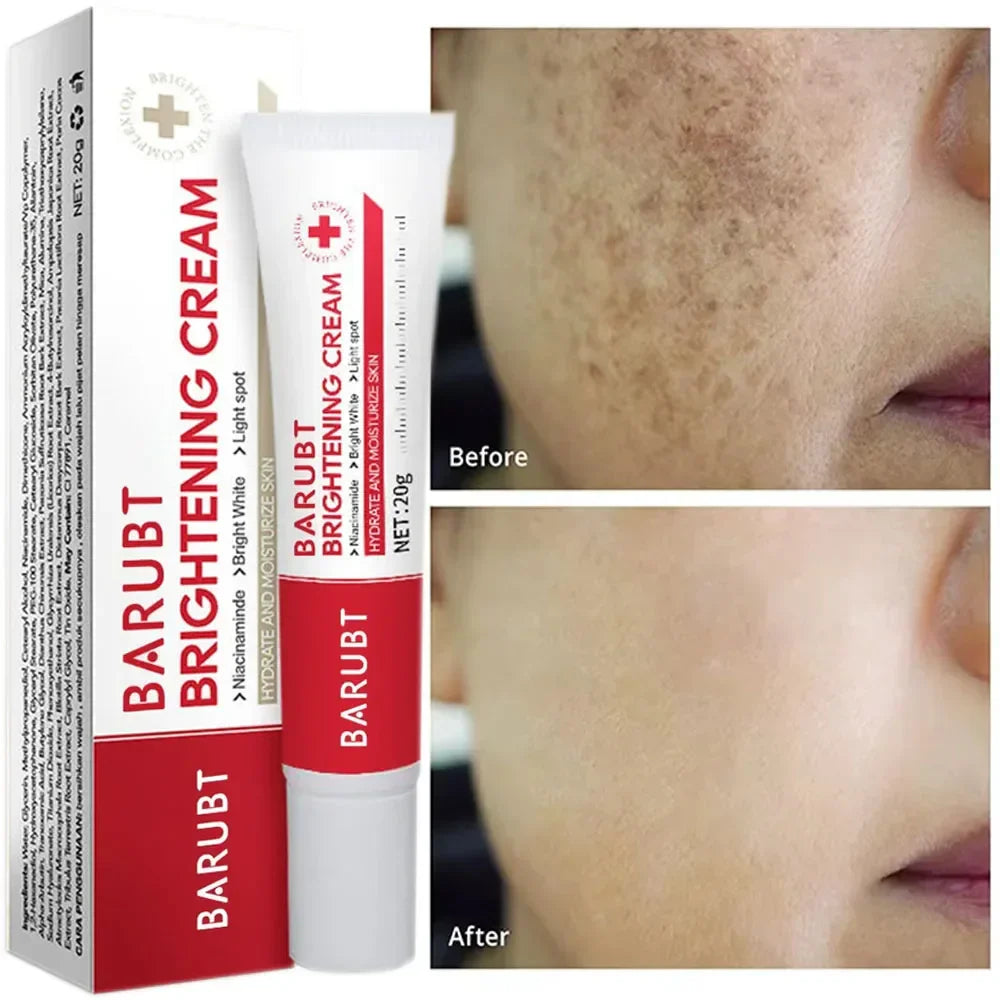 Aurenza Shop dark spot and freckle corrector face cream with niacinamide and vitamin C, showing the jar and product packaging.