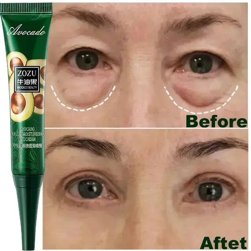 Aurenza Shop Instant Remove Wrinkles Eye Cream with applicator for reducing fine lines, dark circles, puffiness, and tightening under eyes.
