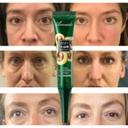 Aurenza Shop instant remove wrinkles eye cream with applicator, showing smooth, bright under-eye skin and reduced puffiness.