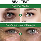 Aurenza Shop Instant Remove Wrinkles Eye Cream showing a jar of anti-aging eye cream for dark circles and puffiness.