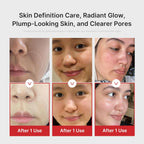 Medicube AGE-R Booster-H K-beauty glow booster device showing a sleek handheld skincare device on a white background.