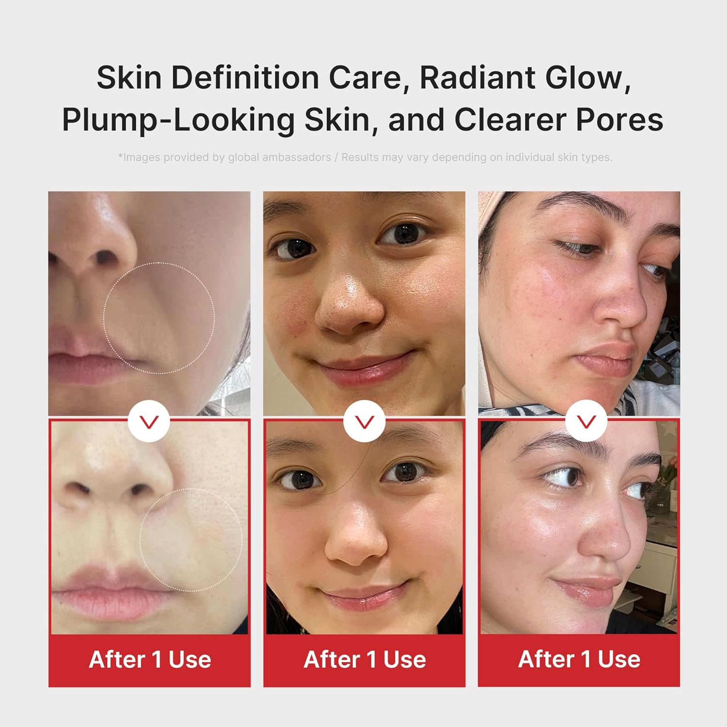 Medicube AGE-R Booster-H K-beauty glow booster device showing a sleek handheld skincare device on a white background.
