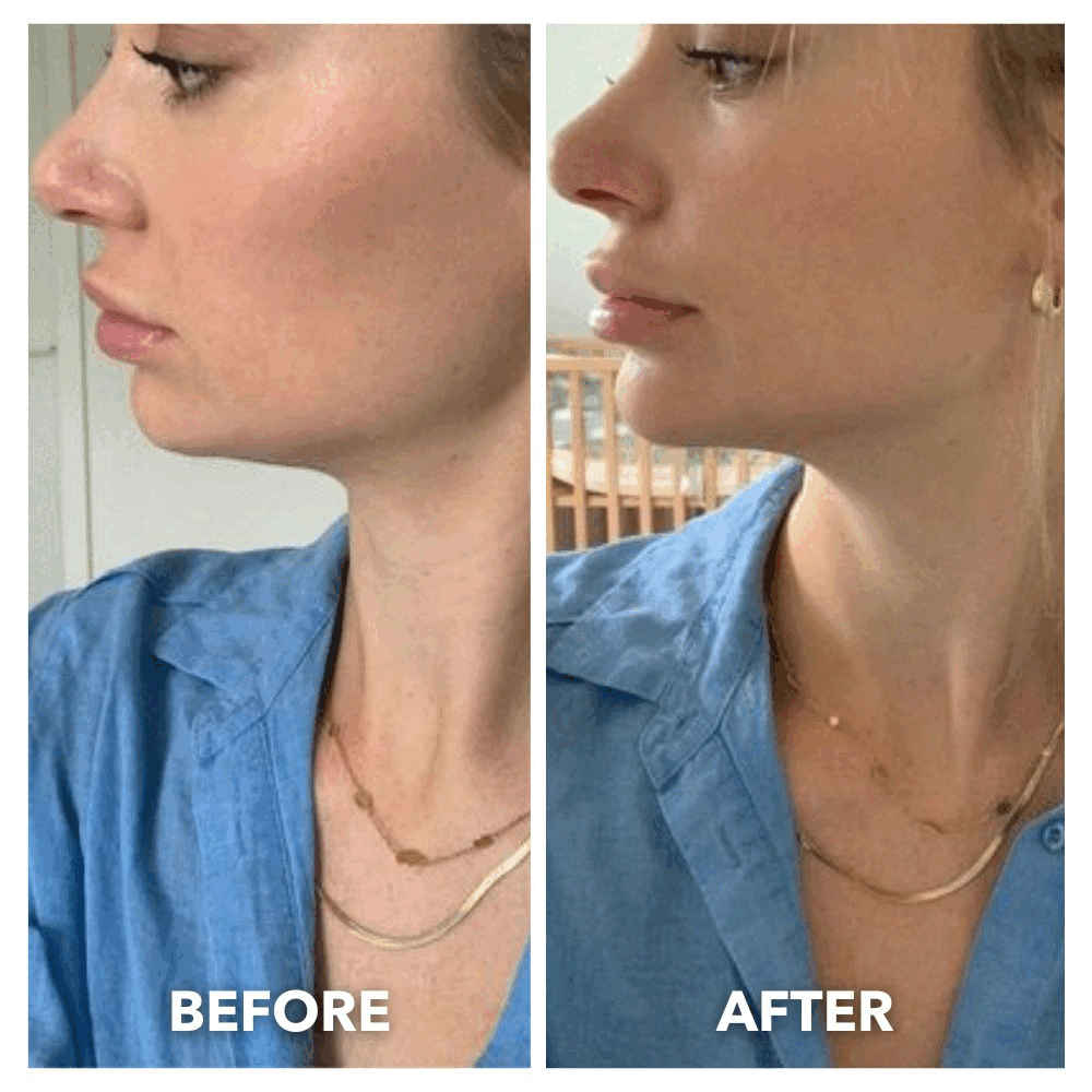 Reusable V-Lift Pro chin strap by Aurenza Shop for sculpted and toned jawline, shown in a clear animated image.