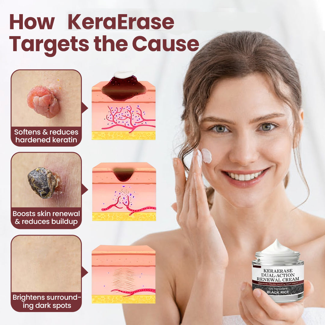 Two jars of Aurenza Shop KeraErase Dual-Action Renewal Cream, English brand skincare product with a clean, white and gold packaging.