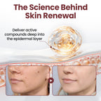 Two jars of Aurenza Shop KeraErase Dual-Action Renewal Cream with natural ingredients and smooth texture, close-up shot.