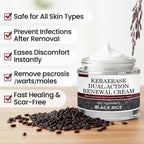 Two jars of Aurenza Shop KeraErase Dual-Action Renewal Cream for skin renewal and hydration, shown in a close-up image.