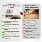 Two jars of Aurenza Shop KeraErase Dual-Action Renewal Cream, English packaging, shown side by side.