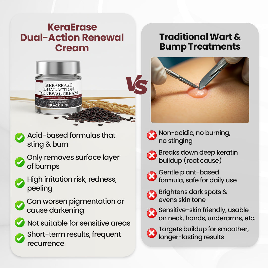 Two jars of Aurenza Shop KeraErase Dual-Action Renewal Cream, English packaging, shown side by side.