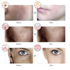 Aurenza Shop Kahuna Red Therapy Facial Mask massager showing the red facial mask device with controls and ergonomic design.