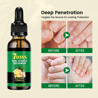 Aurenza Shop Ginger Nail Rescue Oil bottle with herbal ingredients, designed to strengthen and protect nails naturally.