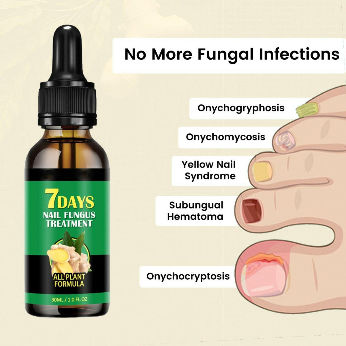 Aurenza Shop Ginger Nail Rescue Oil bottle with natural herbal ingredients, designed to nourish and strengthen nails.