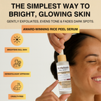 Aurenza Shop Rice Peel Shot Glow exfoliating serum bottle with white label and dropper, designed for skin brightening and exfoliation.