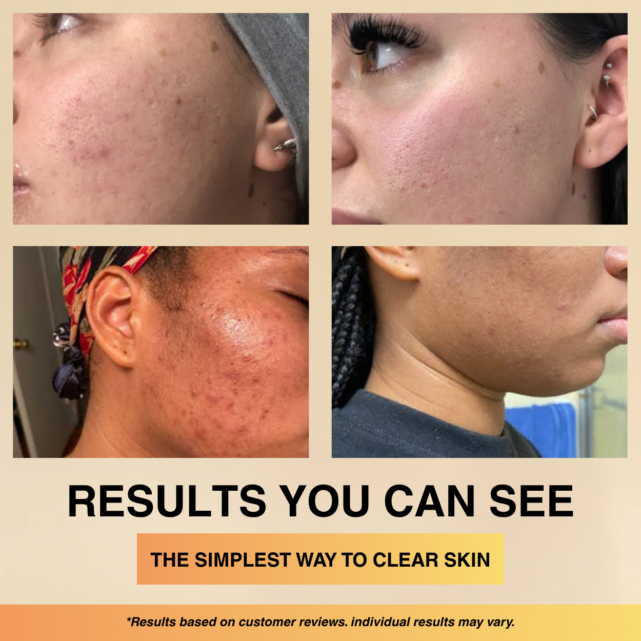 Aurenza Shop Rice Peel Shot Glow exfoliating serum bottle with white packaging and product label visible.