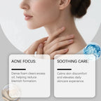 Aurenza Shop Bacne Out Bar Acne Control Soap, natural soap bar for acne-prone skin, shown with its packaging.