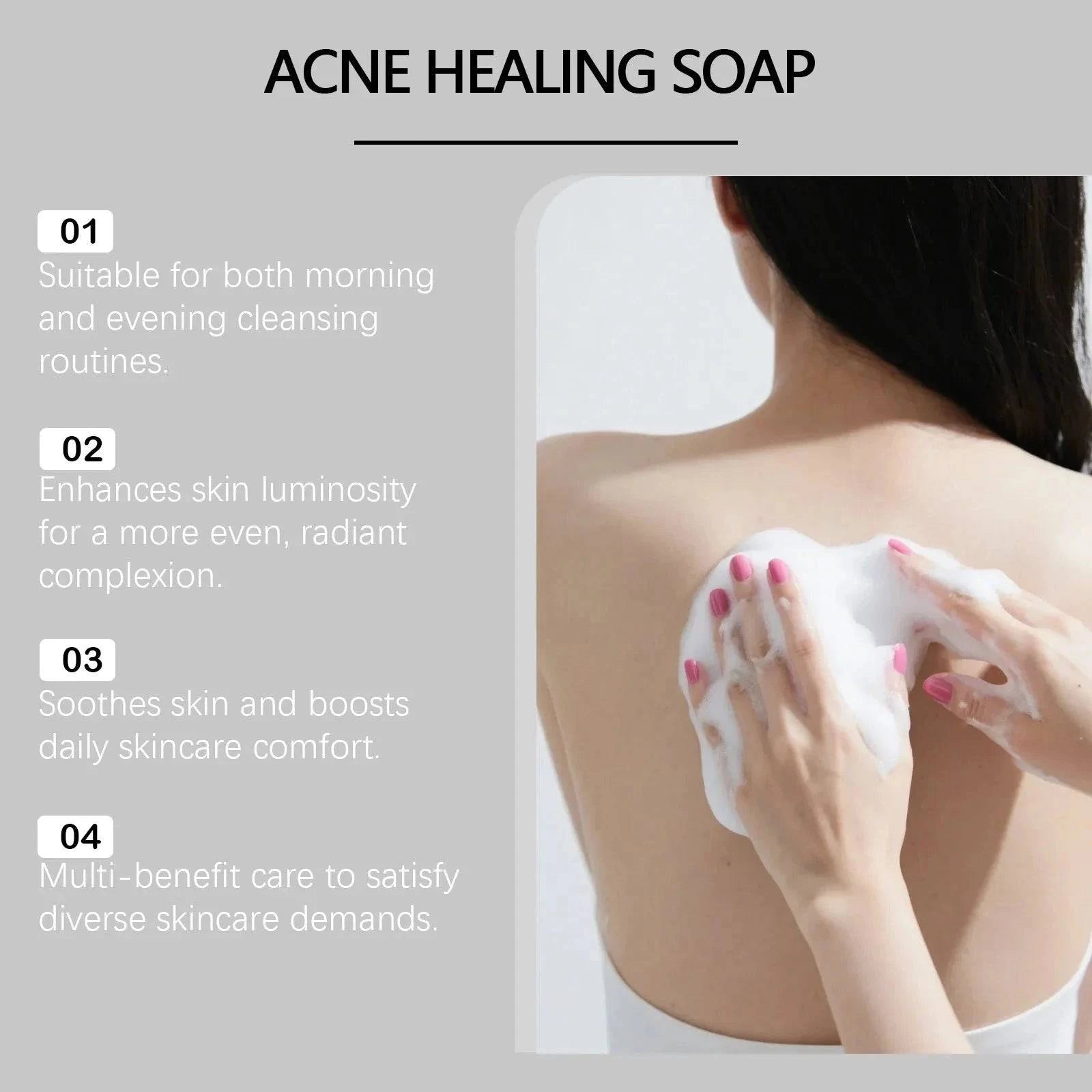 Aurenza Shop Bacne Out Bar Acne Control Soap with natural ingredients for clearing back acne and blemishes.