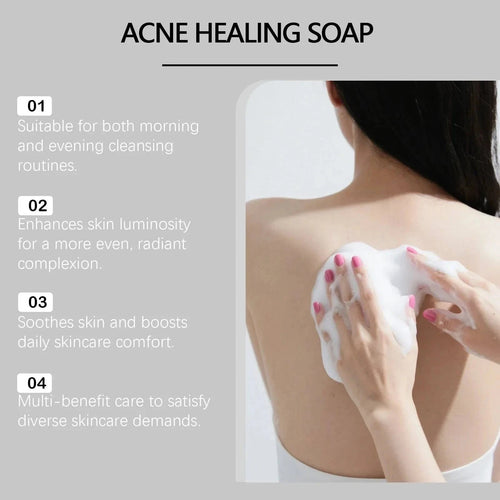 Aurenza Shop Bacne Out Bar Acne Control Soap with natural ingredients for clearing back acne and blemishes.