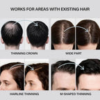 Aurenza Shop Hair Building Fibers kit for thinning hair, featuring fibers for men and women, in a 2-in-1 hair enhancement set.