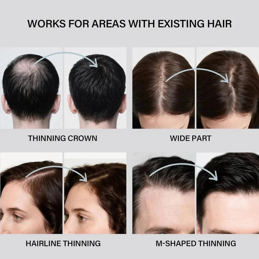 Aurenza Shop Hair Building Fibers kit for thinning hair, featuring fibers for men and women, in a 2-in-1 hair enhancement set.