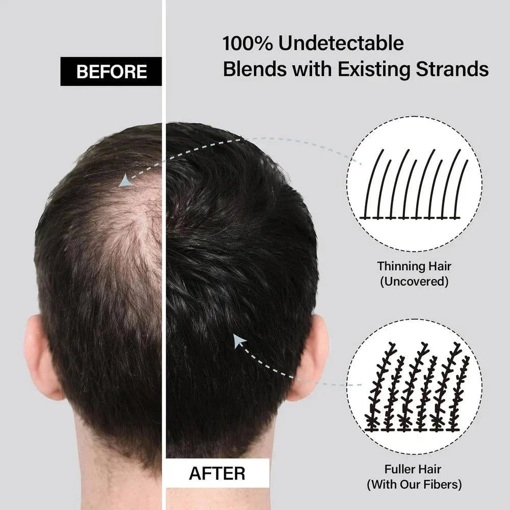 Aurenza Shop hair building fibers kit for thinning hair, includes fibers for men and women to enhance hair volume naturally.