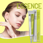 Korean Retinol Eye Cream by Aurenza Shop showing the creamy moisturizer in a jar, designed to exfoliate, brighten, and reduce pores around eyes.