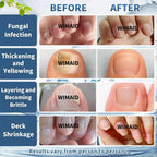 Extra Strength Nail Fungus Treatment – Triple Action Formula Repairs Thick, Yellow & Damaged Nails Fast