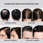 Hair Building Fibers for Thinning Hair for Men Women, 2-In-1 Kit- Enhancements B