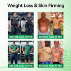 (BUY 1 GET 3) 1-5Boxes Moringa Berberine NAD+ Weight Loss Patches Advanced Nano Microneedle
