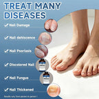 Extra Strength Nail Fungus Treatment – Triple Action Formula Repairs Thick, Yellow & Damaged Nails Fast